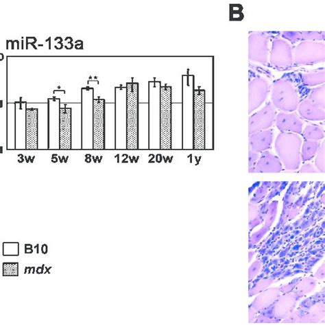 A Expression Levels Of Mir 1 Mir 133a And Mir 206 In Ta Muscles Of