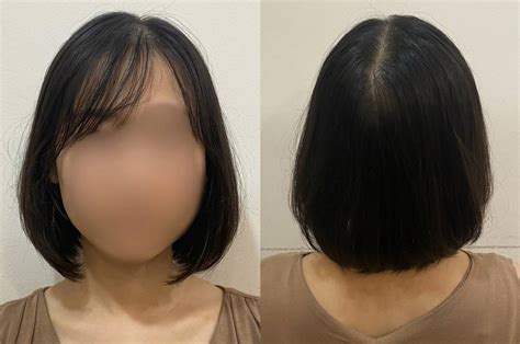 薄毛 髪型ひし形ショートでボリュームアップ 薄毛に悩む女性の為のヘアサロン美容院TELASテラス東京大阪