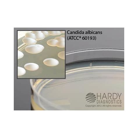 Emmon S Sabdex Sabouraud Dextrose Agar