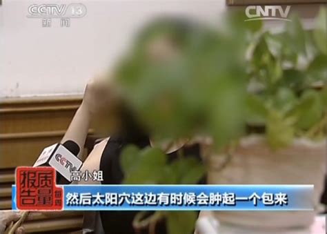 央视曝整容行业乱象10年20万张脸被毁掉图国内新闻温州网