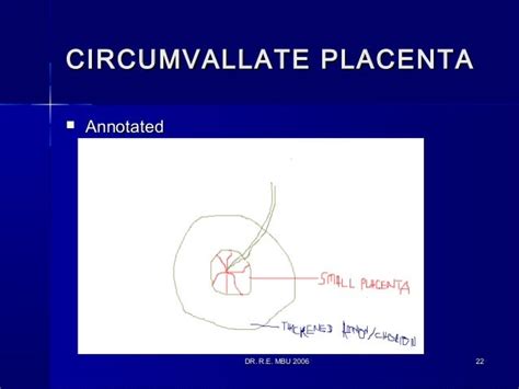 The Placenta And Its Abnormalities