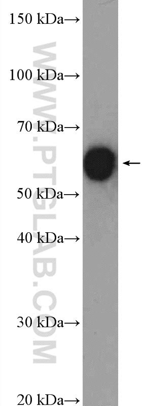 CCT8 antibody 12263 1 AP Proteintech 武汉三鹰生物技术有限公司