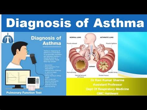 Diagnosis Of Asthma Gina Youtube