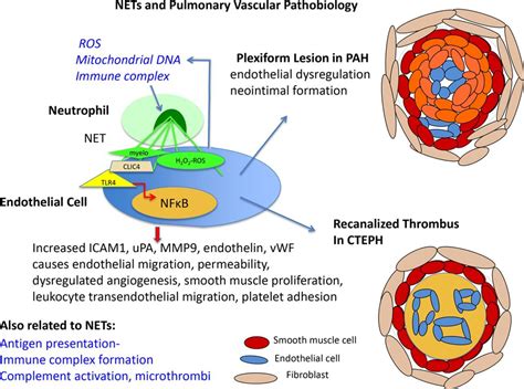 NETs Activate Pulmonary Arterial Endothelial Cells Arteriosclerosis