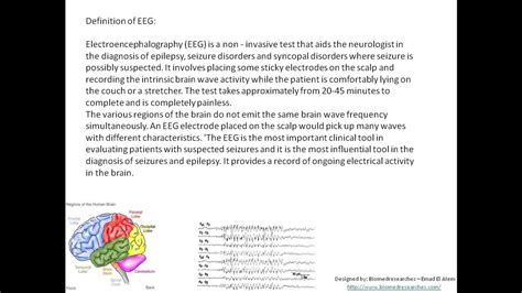 Understanding Eeg Part5 Eeg Electroencephalography Test Definition Introduction And