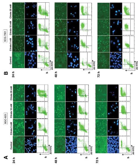 Citrate Induces Apoptotic Cell Death A Promising Way To Treat Gastric