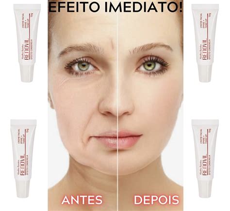 Creme Facial Efeito Cinderela Rejuvenescimento Dmae Mercado Livre