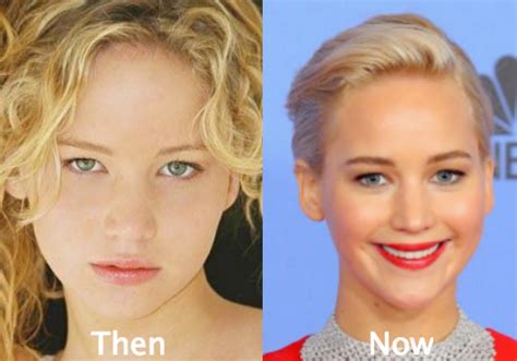 Jennifer Lawrence Plastic Surgery Before And After Nose Job Latest