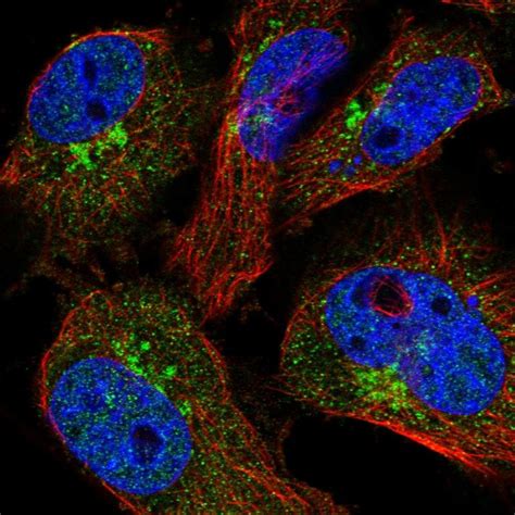 Rabbit Polyclonal Anti Cope Antibody Buy For Research Highly