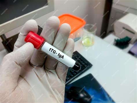 Premium Photo | Blood sample for tissue transglutaminase antibody or ttg iga for the diagnosis ...