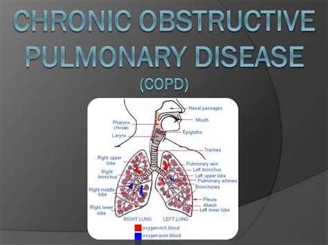 Ppt Chronic Obstructive Pulmonary Disease Copd Powerpoint