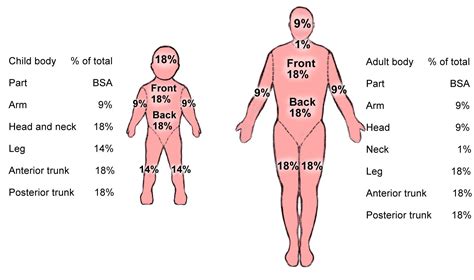 Sci Study Time Rule Of Nine Burns Burns Nursing Physical Therapy