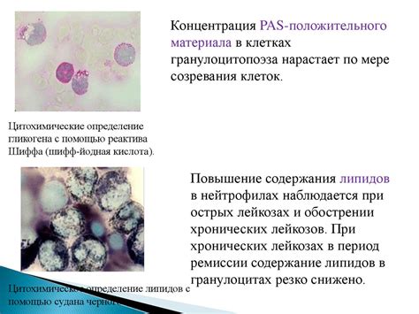 Хронические миелопролиферативные заболевания - презентация онлайн