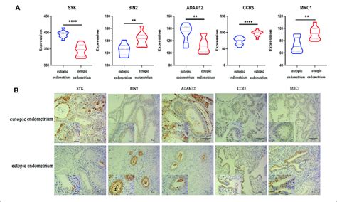 Results Of Qrt Pcr And Ihc Analysis A Relative Expressions Of Five