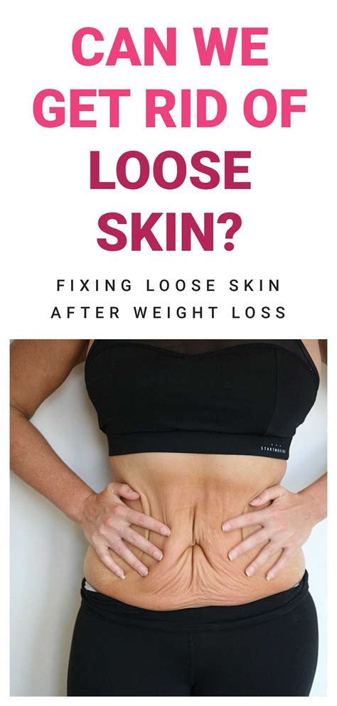 The Truth About Loose Skin After Weight Loss Can We Tighten Loose Skin Artofit