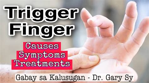 Trigger Finger Causes Symptoms And Treatments Dr Gary Sy Youtube