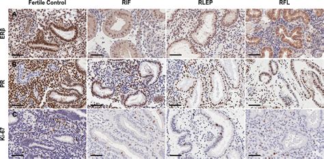 Representative Micrographs Demonstrating A Er B Pr And C Ki