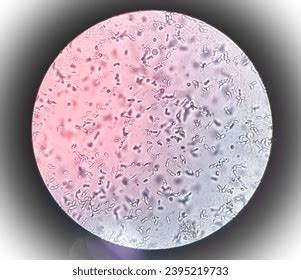 Urine Sediment Microscopic Examination Show Plenty Stock Photo ...