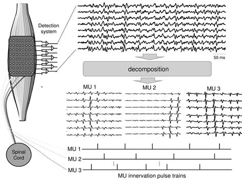 Schema Of The Process Of Decomposition Of Multi Channel Surface Emgs