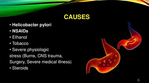 Treatments For Peptic Ulcer