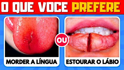 O Que Voc Prefere Edi O Extrema As Escolhas Mais Dif Ceis De