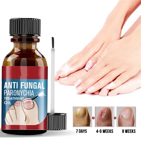 Toenail Fungus Treatment Extra Strength - Toe Nail Fungus Treatments