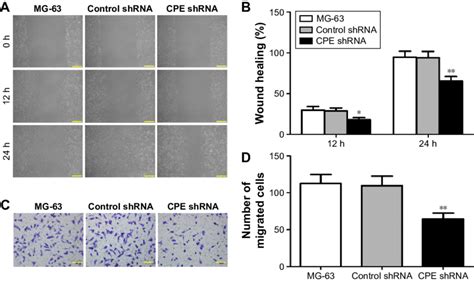 Silencing Of CPe Decreases The Invasive And Migratory Properties Of