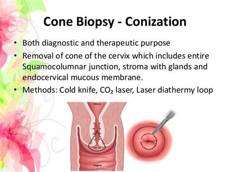 Cervical Biopsy Obstetrics And Gynaecology