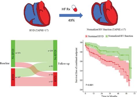 Publication: Right ventricular dysfunction in patients with new-onset ...