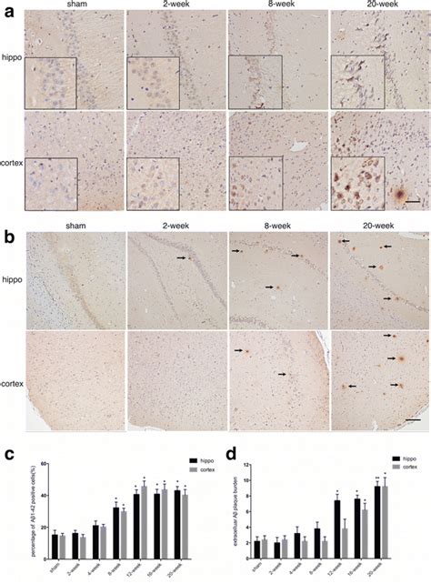 Intracellular A Positive Cell Expression And Extracellular A Plaque