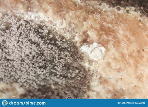 Rhizopus Bread Mold Under The Microscope Stock Photo Image Of