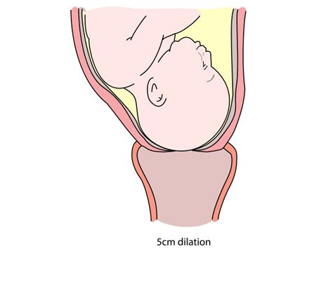 Stages Of Labor Dilation