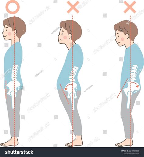 Sample Good Bad Posture Men_pelvis Stock Vector (Royalty Free