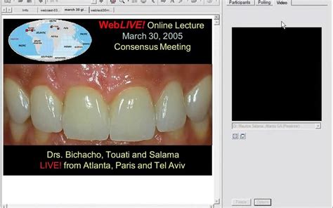 Contemporary Approaches To Soft Tissue Behavior Around Dental Implants Videdental