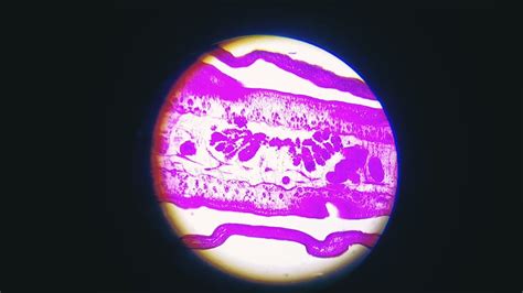 Mature Proglottid Of Tapeworm Taenia Solium Under My Microscope 10X