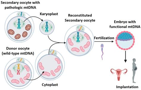 Ijms Free Full Text Mitochondrial Dna Replacement Techniques To Prevent Human Mitochondrial