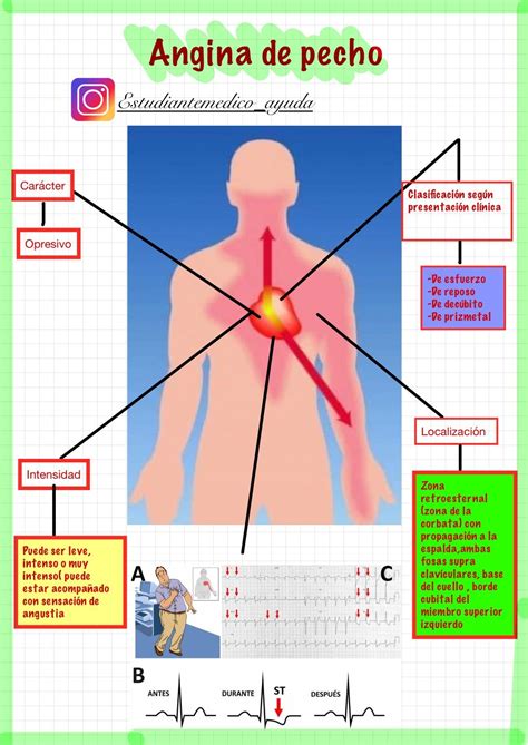 Que Es Angina De Pecho Combi