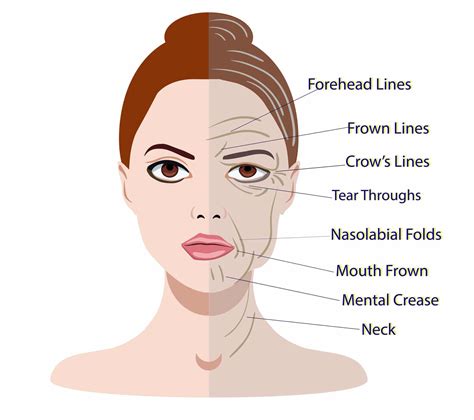 Face Aging Types at Jaclyn Glenn blog
