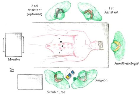 Laparoscopic Radical Prostatectomy | IntechOpen