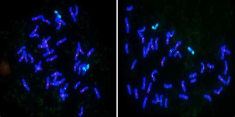 Fluorescent In Situ Hybridization Signals Observed For The Double Download Scientific Diagram