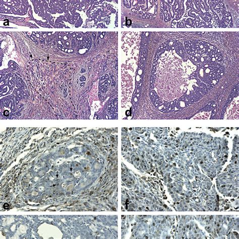 Histopathology Of Dmba Induced Mammary Tumors Histopathological