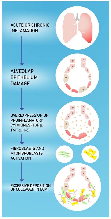 JCM Free Full Text COVID 19 The Potential Treatment Of Pulmonary