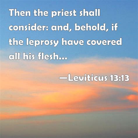 Leviticus 13 13 Then The Priest Shall Consider And Behold If The