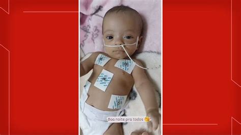 Bebê de 5 meses atropelada por motorista bêbado no DF está na UTI mas