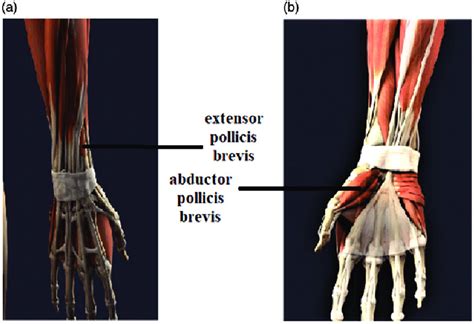 The main function of the abductor and extensor muscles is to abduct the... | Download Scientific ...