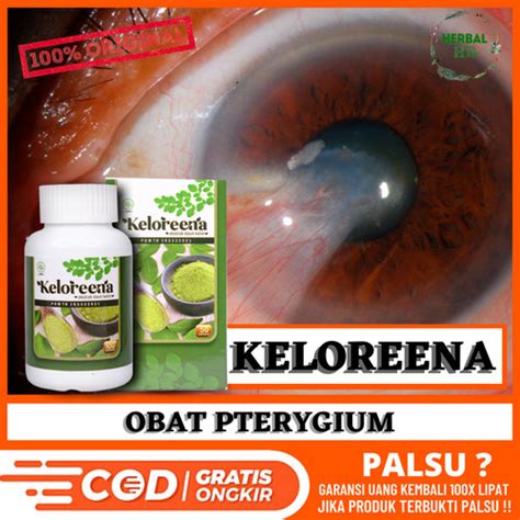 Jual Obat Pterygium Obat Untuk Mata Berlemak Hilangkan Selaput Pada