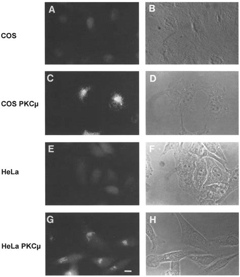 Localization Of Pkc~ In Transfectants By Indirect Immunofluorescence