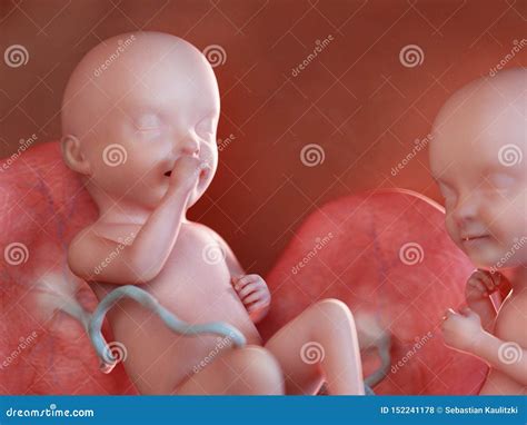 Twin Pregnancy Anatomy Of Womb With Twin Fetuses Dizygotic Royalty