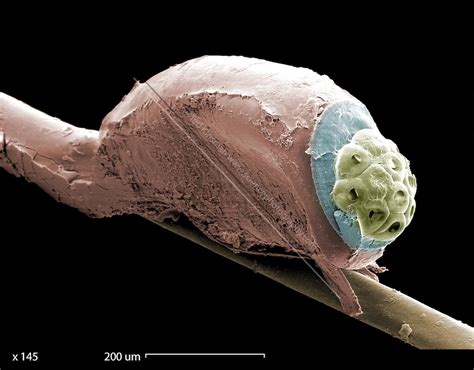 Head Lice Under Microscope