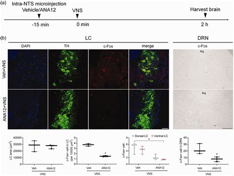 Vagus Nerve Stimulation Inhibits Cortical Spreading Depression Via